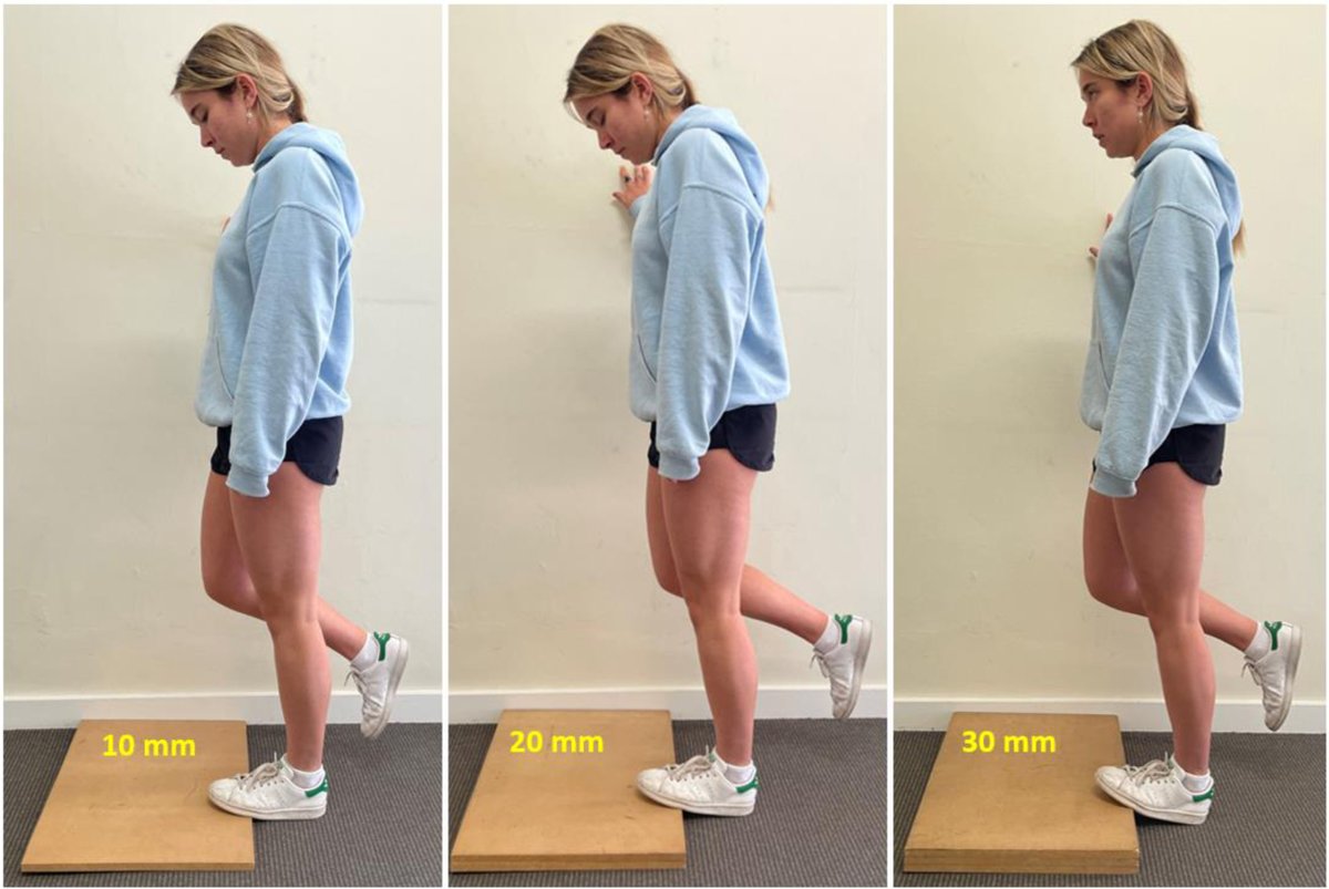 There's noone better to summarise the truckload of research into Achilles tendinopathy than Peter Malliaras in his Invited Topical Review, which covers diagnosis, aetiology, prognosis, and all aspects of physiotherapy management. bit.ly/3hGwTnv
