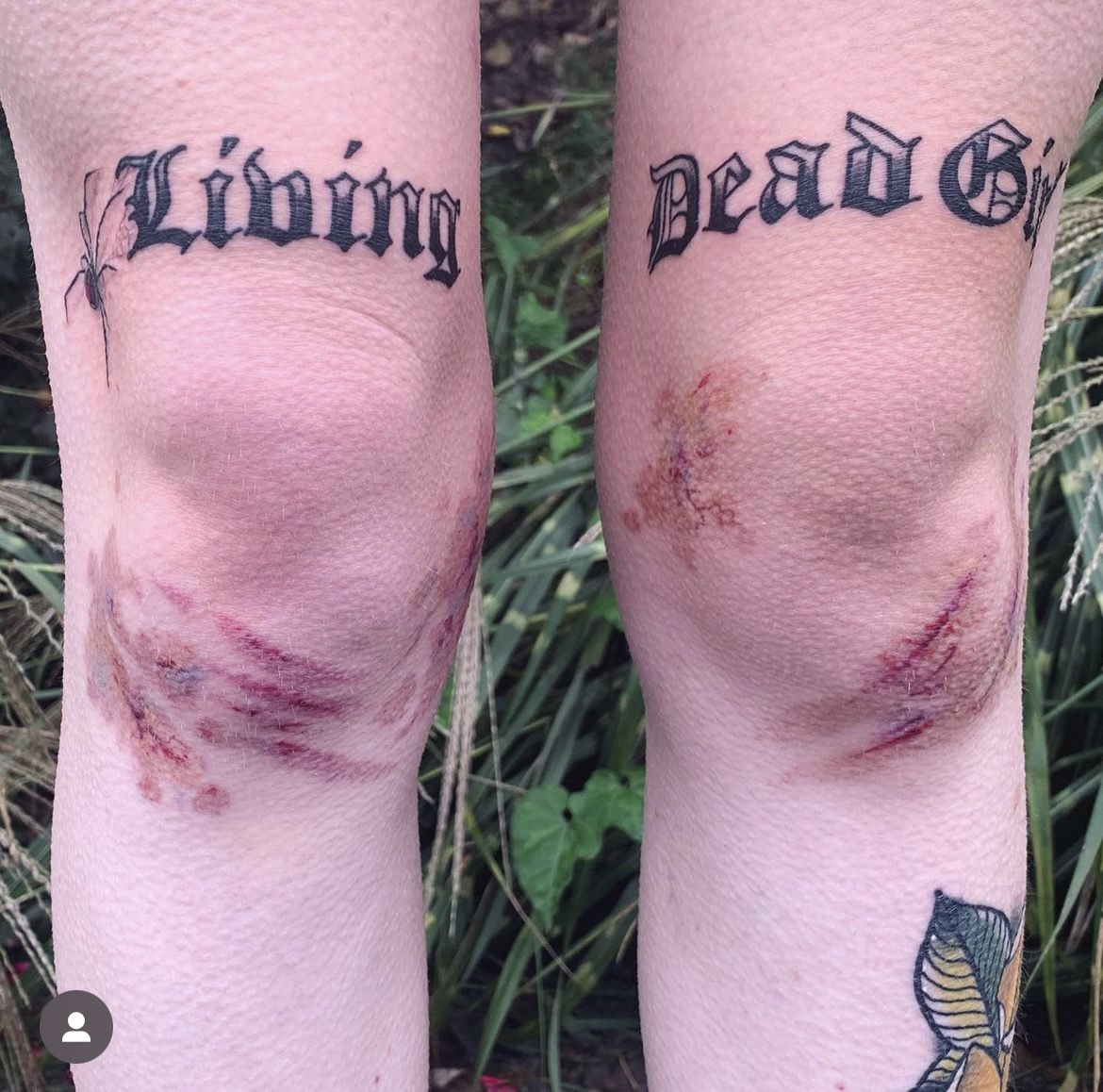 ic3kpeak's tweet photo. queria tanto achar algum tatuador FODA aq em sp que faça tatuagem de hematoma juro q to OBCECADA https://t.co/RduGguHwna