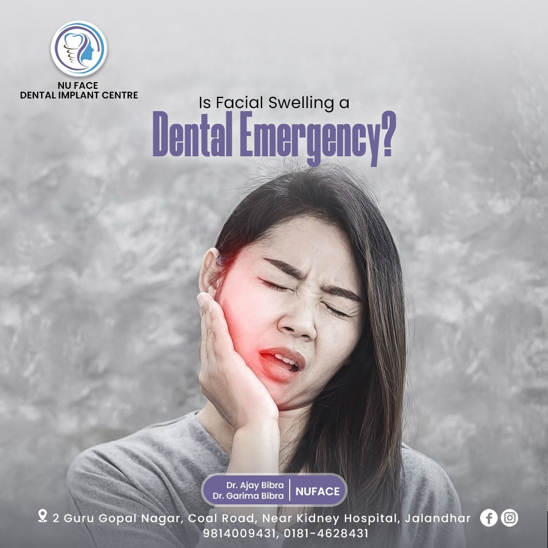 Nufacedental1's tweet image. Don't take facial swelling and discomfort lightly. It may be a sign of a dental emergency called an abscessed tooth.

To know more, make an appointment with our experts at Nuface Dental Clinic &amp;amp; Implant Center today!

#nufacedentalimplantcentre
#faceswelling #teethproblems