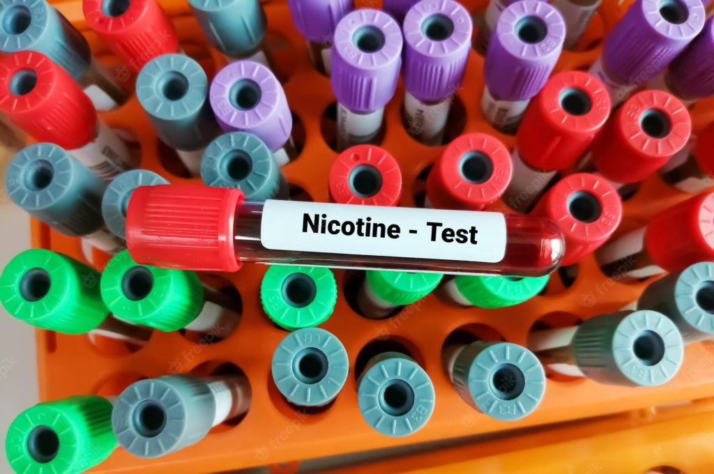 myvapereview's tweet image. Check Out Everything You Should Learn Before a Nicotine Test🧐

👉myvapereview.com/guides/what-to…

#vapingguide #nicotinetest #vape #vaping #vapecommunity #vapelife #vapinglover #vapelifestyle #vapephotography ⁣⁣#vapephoto #vapepics ⁣⁣#alldayvape #vapegood #vapingislife