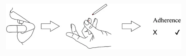 AnalBioanalChem's tweet image. Closing the gap — development of an analytical methodology using volumetric absorptive #microsampling of #finger prick blood followed by LC-HRMS/MS for adherence #monitoring of antihypertensive drugs
by Markus R. Meyer et al @Saar_Uni 

#OpenAccess 
link.springer.com/article/10.100…