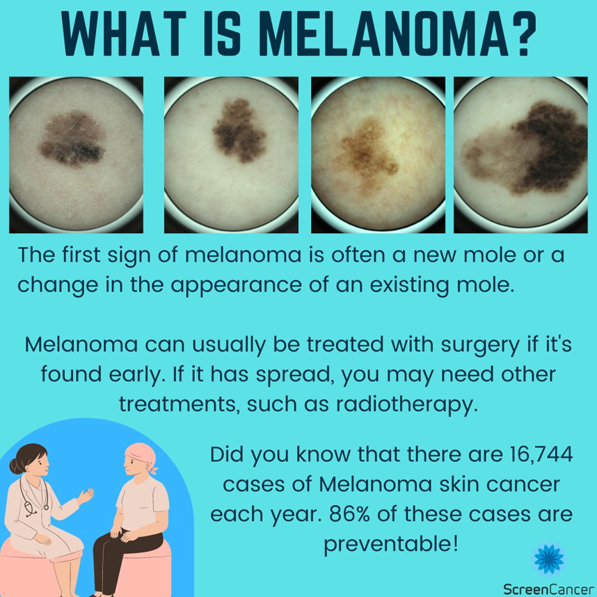 ScreenCancer_UK's tweet photo. Have you got a lesion that looks like this? 
Have you had it checked out yet?🤔If not, visit https://t.co/BB3Dw56qOK or DM📥 us for more info/ to book an appointment.
Remember early detection really does saves lives! 
#cancer #melanoma #skin https://t.co/NHXTfpOGXT