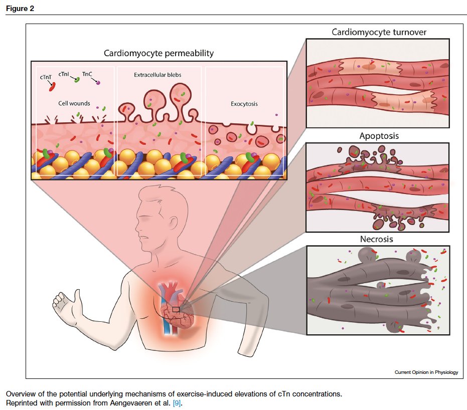 ThijsEijsvogels's tweet photo. Our latest review paper: #Cardiac #troponin release in #athletes: what do we know and where should we go?

Open access availability via: https://t.co/klgNc8i0J4 https://t.co/7IGISrnUin