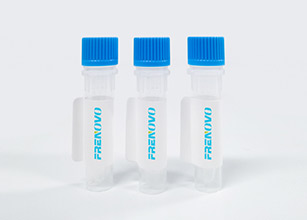 frenovo's tweet image. S protein is the most important membrane protein on the surface of coronavirus, while N protein is another important structural protein in coronavirus. S protein and N protein are the key raw... frenovobio.com/products/covid… #myotest #ntprobnptest