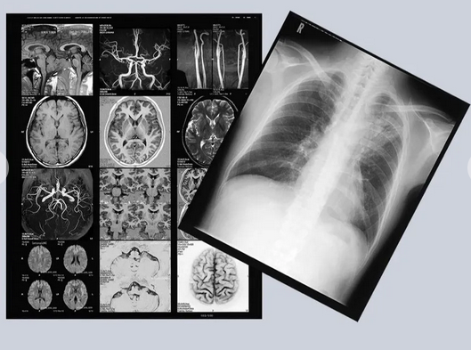 MedicalRey's tweet photo. Designed for liner gradations from low-through high-density areas, sharp clear images are assured by optimized control of image tones.
Thermally processed dry film that delivers optimum image quality for all image modalities.
Medical Dry Imaging Film SD-S @KonicaMinoltaMI https://t.co/4d4W5T36i7