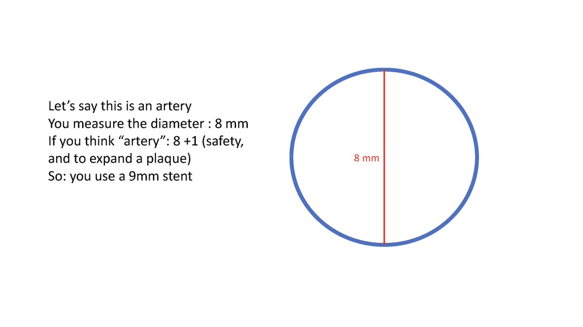 PierreGobinMD's tweet photo. Stent measurement for venous sinus stenting https://t.co/PEofrlBmB4