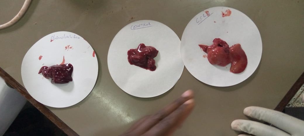 From left to right: Distilled alcohol liver, healthy liver and finally illicit brew liver. Take care...