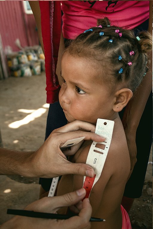 Más del 60% de la población evaluada en el proyecto q desarrollamos junto a <a href="/GOAL_Colombia/">GOAL_Colombia</a> en comunidades de #Anzoátegui tuvo que ser atendida por desnutrición aguda o riego alto de desnutrición.335 personas están recibiendo tratamiento y mejorando gracias al apoyo de <a href="/Irish_Aid/">Irish Aid</a>