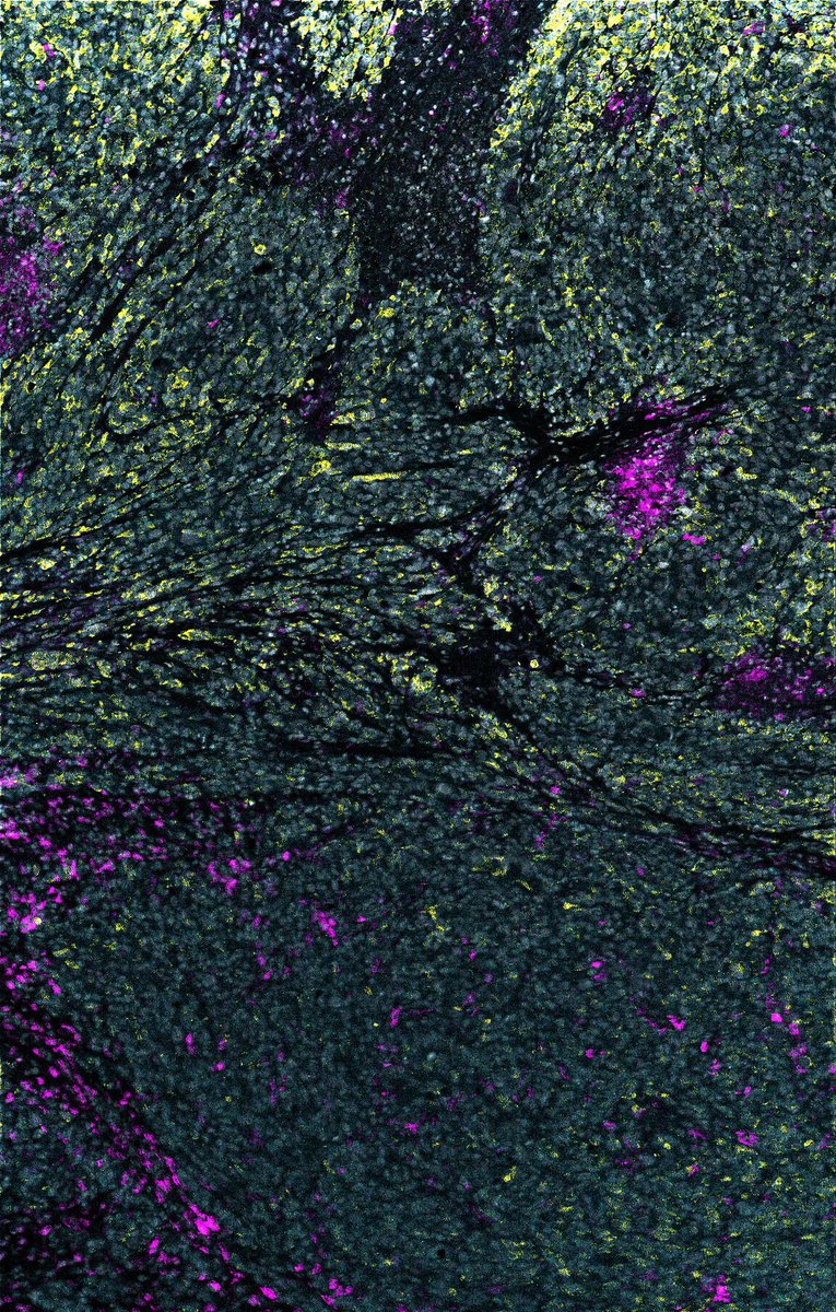 UCDsmj's tweet photo. Immune cells in the spleen! Don’t they look like stars! https://t.co/fJp1Tc845m