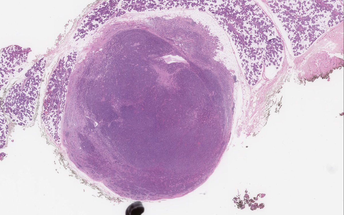 WeinrebIlan's tweet photo. Parotid tumour. What am I? https://t.co/q87PrHRLtO