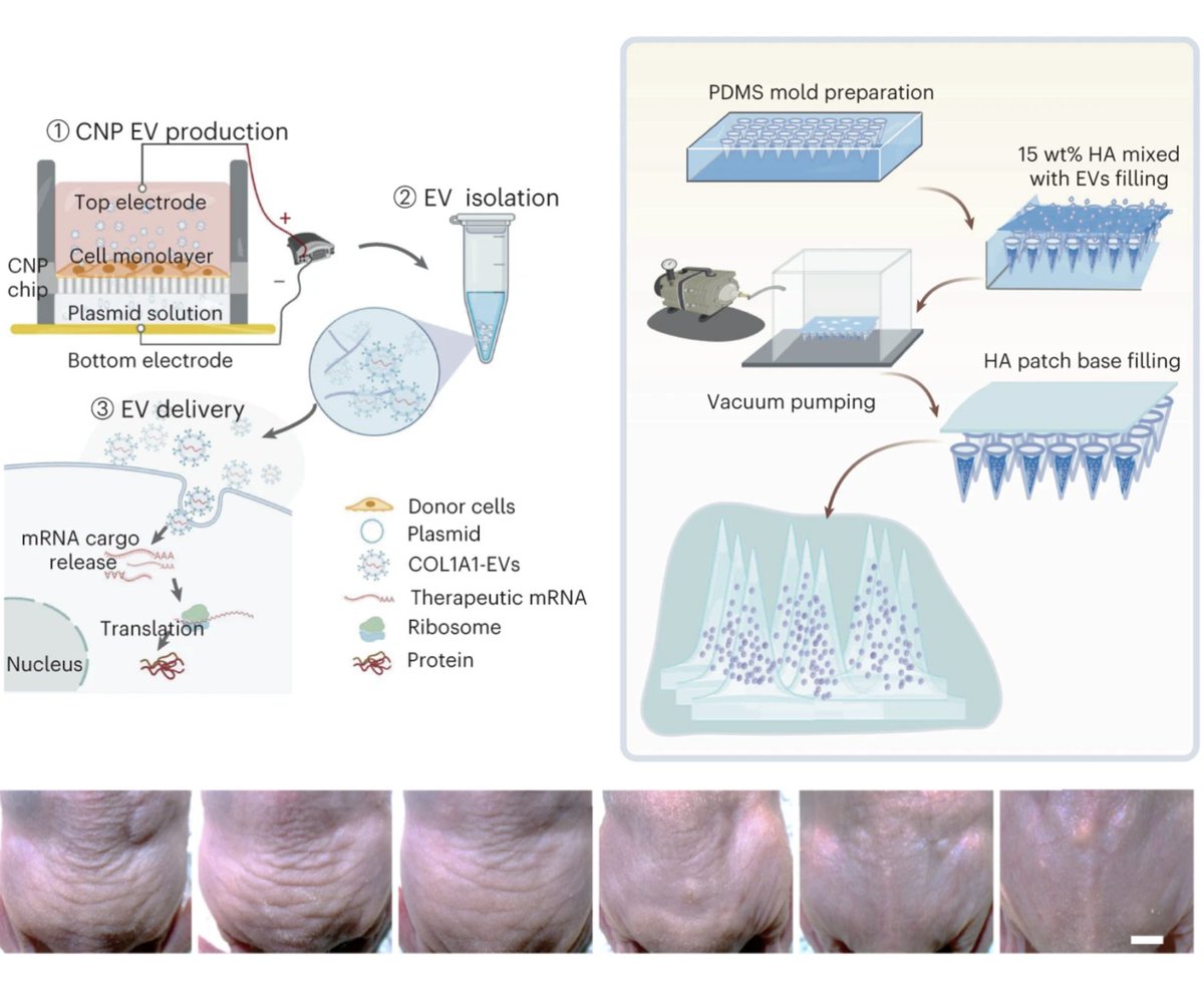 BettyKimLab's tweet photo. Excited to share our study @natBME https://t.co/KbeVZkmbOu The next demystifying anti-#aging, technology for younger-looking skin and beyond? #proteinloss #exosome #antiwrinkle @oncsurgery @MDAndersonNews @wenjiang_nano Andrew Lee @DaeYongLee5 @YWangPhD @KristinHuntoon @tdgallup https://t.co/cclKXT0KYR