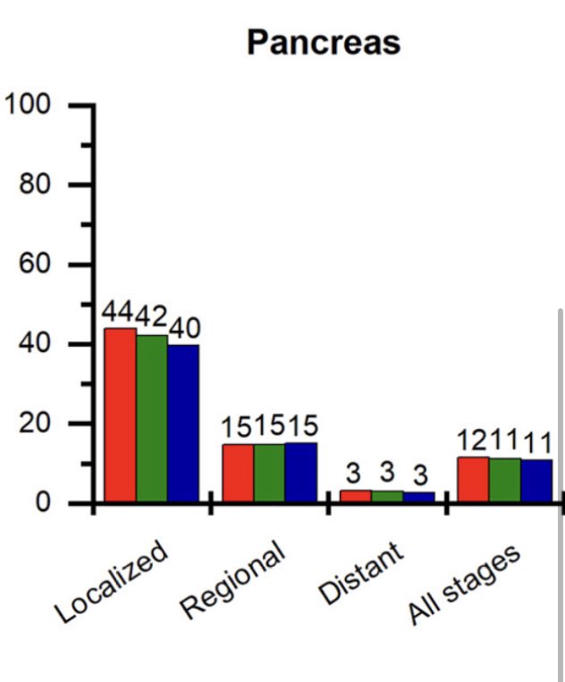 A 20y timeline on stage at diagnosis &amp; survival in #PancreaticCancer.
Per Cancer Statistics 2003, the five year survival of pancreatic cancer overall was 4%. 
In 2022 it is 12%. 
Most of those survival gains have come in localized (17% 👉🏽 44%) &amp; regional (7% 👉🏽 15%) disease.