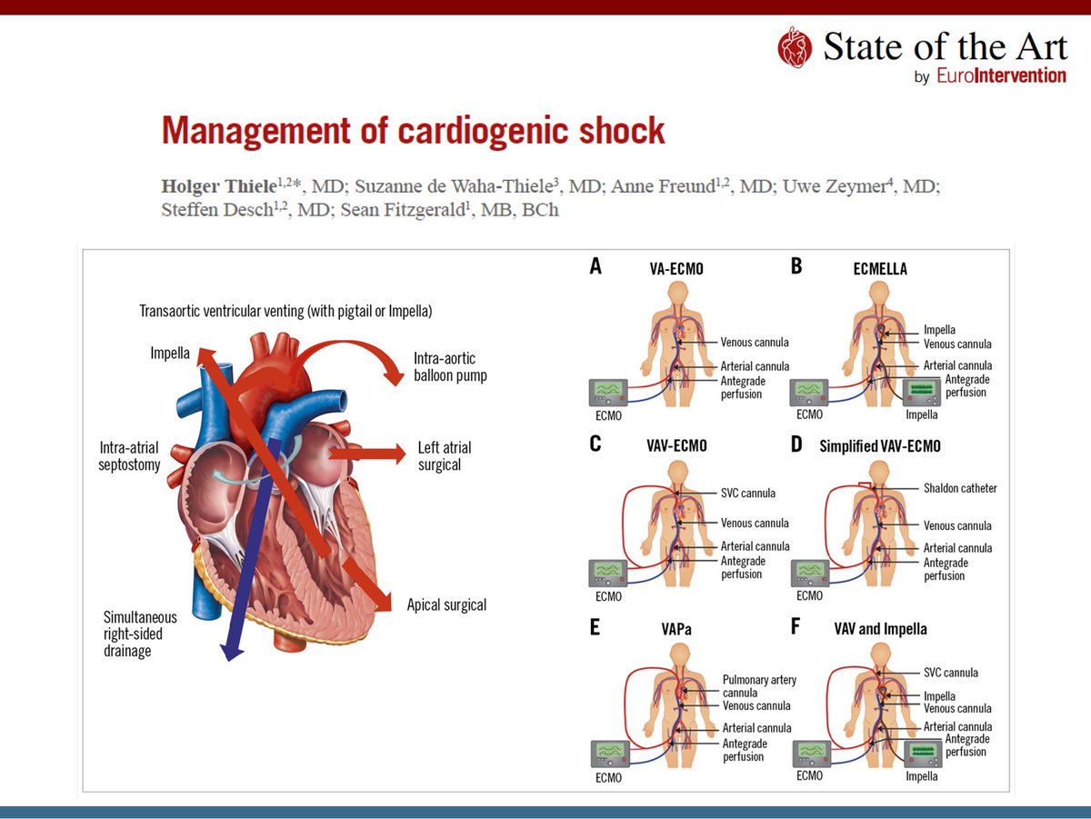 This #EIJBestOf State-of-the-Art paper reviewed the management of cardiogenic shock, especially after acute myocardial infarction, with a major focus on current treatments and practices based on the latest clinical literature. ow.ly/y1hG50MpcQ6