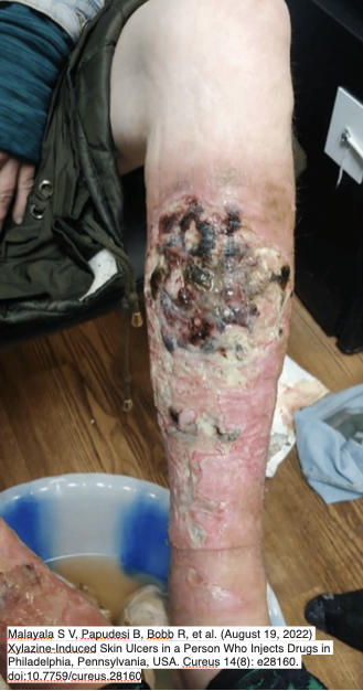 Ben Weston, MD, MPH tweet media