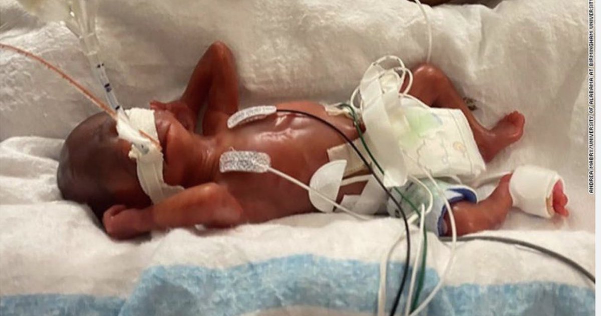 Imagine a party so evil they want laws that would leave this baby to die in anguish after a failed abortion. Democrats voting against the Born-Alive Act is pure evil