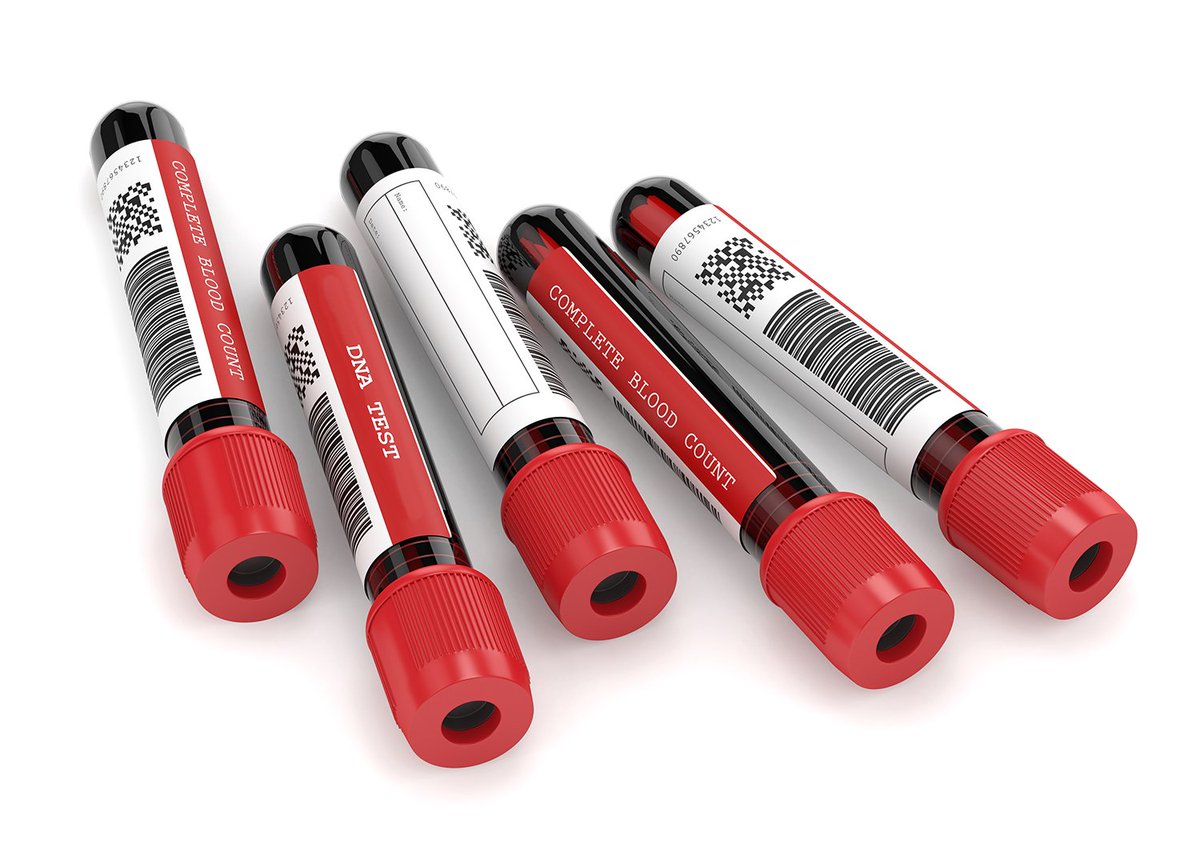 VrtlGraphicsLLC's tweet photo. Want DT labels that last for years outside??? RevealPro

-Synthetic face stock 
-BPA/BPS/Phenol free
-Resistance to heat, cold, UV light, water 
-Like TT BOPP and a wax/resin ribbon
-Images in existing thermal printers

https://t.co/kqkDTpxev0
#bpafreedt #phenolfree #recyclable https://t.co/smrqZPHyvs