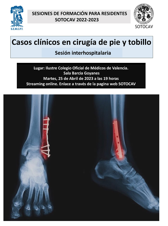 ¡¡ Comenzamos 2023 con la formación nacional de tobillo - pie, de la mano de SEMCPT !!

No te pierdas los primeros eventos del año. 

#semcpt #semcptformación #semcptcursos
