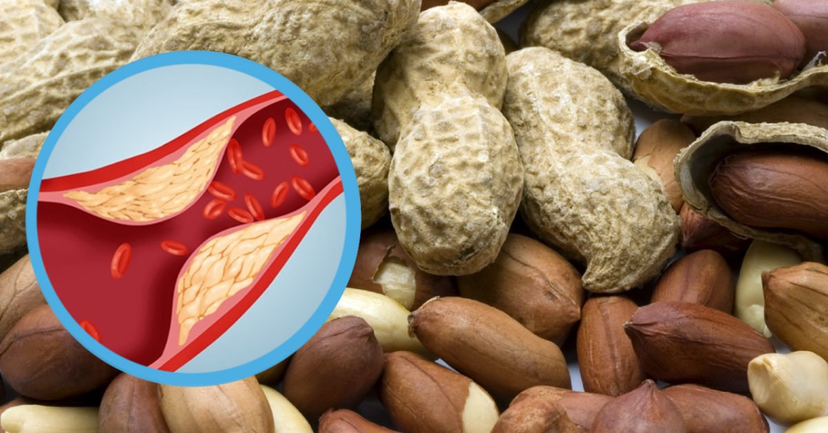 Dr. Paul Cottrell on Twitter "Peanuts help prevent heart disease by