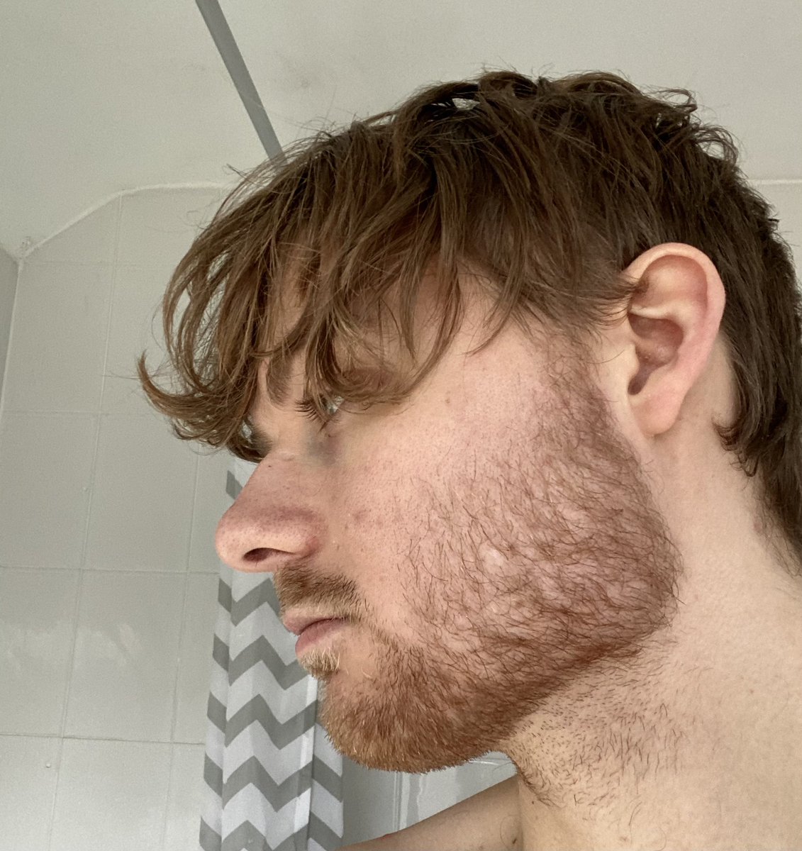 Lewis Rex on Twitter: "Gigachad beard progress 3 weeks"
