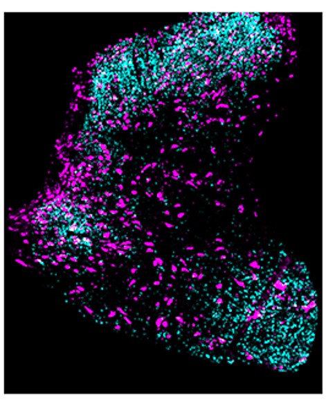 Interested in #regeneration &amp; #spinalcordinjury? 
Want to collaborate with over 15 phenomenal #SCIresearch labs across the EU (incl <a href="/VerhaagenJoost/">Joost Verhaagen</a>)? Living in the EU and want to do a #PhD in London? ONLY 4 DAYS LEFT TO APPLY!
jobs.ac.uk/job/CVR811/mar…