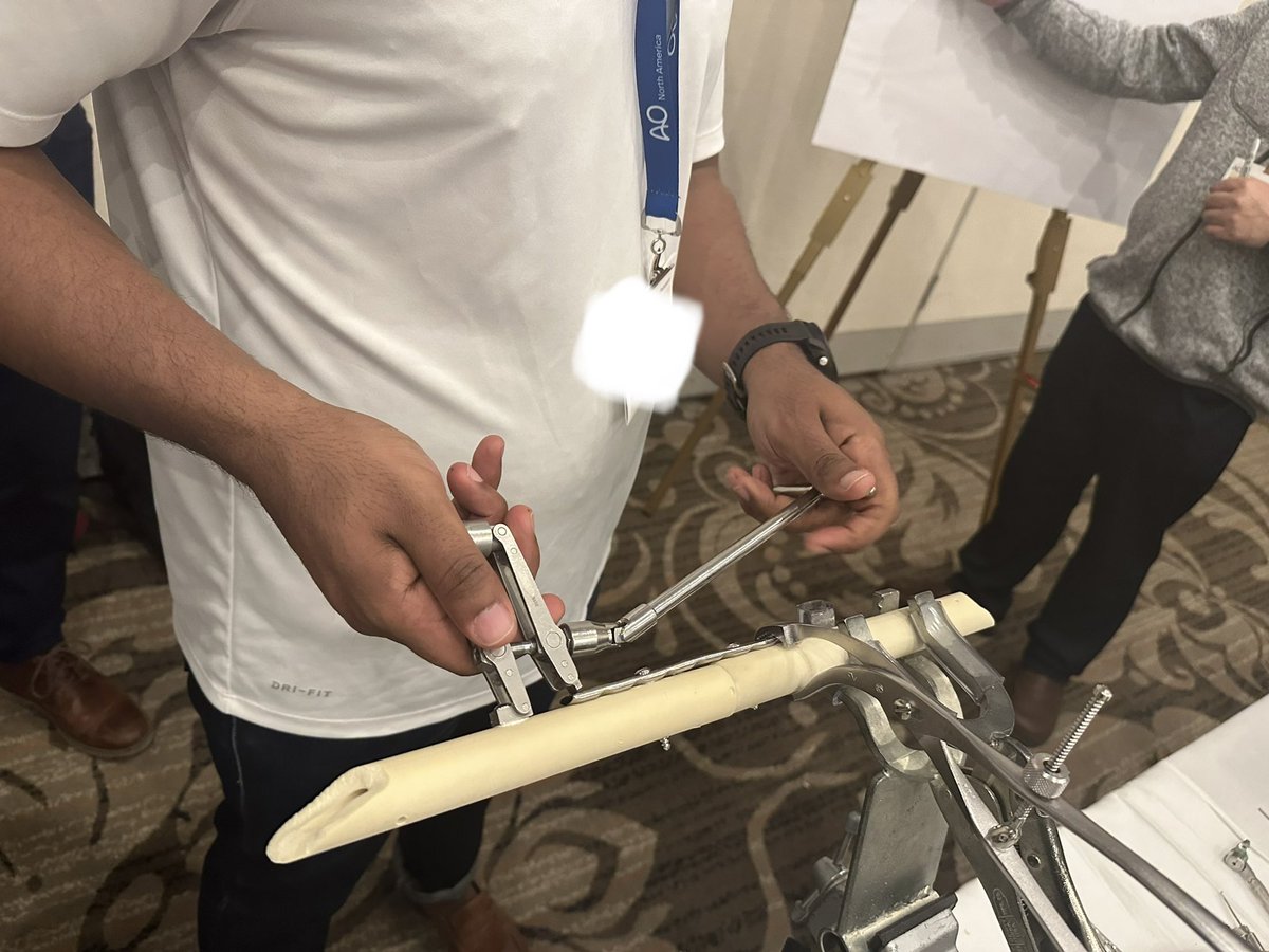 AO Basic Principles Charlotte, Day 1 is wrapping up! Nothing to better illustrate absolute stability principles better than than deploying the ATD. Direct visualization, anatomic reduction, compression, primary bone healing -✅ <a href="/AONorth/">AO North America</a> @aotraumana1