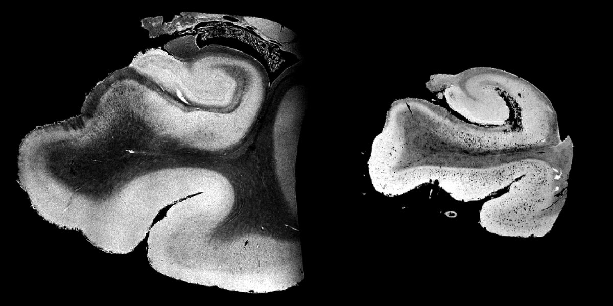 68 hours of #MRI at 16.4 Tesla with 50 micrometer voxels (8000 times > clinical MRI) to collect quantitative MRI (T1, T2, dw-MRI, SWI ..) of Alzheimer's tissue: sciencedirect.com/science/articl… @UQ_CAI @USCLONI @ryancabeen @KorobkovaLaura @Judyshih33 #neuroscience #Neurology #ENDALZ