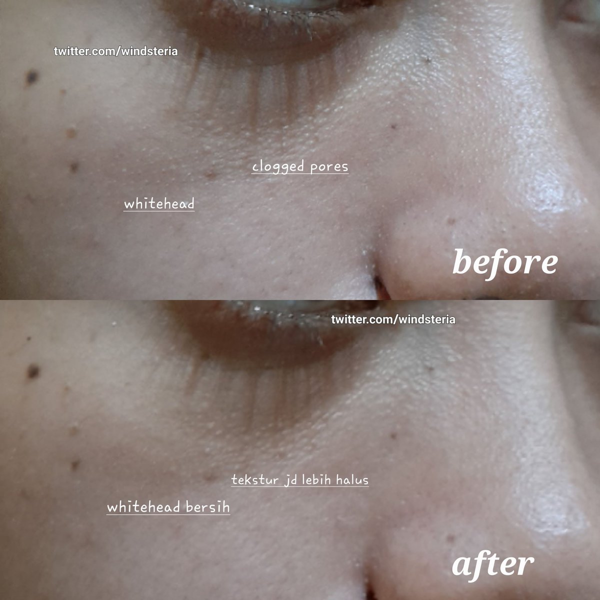 windsteria's tweet photo. Baru pertama kali nyoba clay mask se-easy use ini😍
Beneran travel friendly, gampang dipake udah gitu mantep bgt buat bersihin pori-pori &amp; redain jerawat👍

Skintific Mugwort Anti Pores &amp; Acne Clay Stick, wajib bgt punya!

#racuninskincare #windstory https://t.co/reAFjiZw11