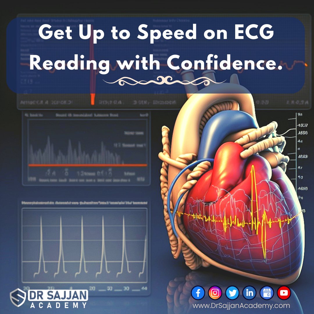 dynamicsajjan's tweet image. #ECGBasics #ECGAnalysis #ECGDiagnosis #ECGTechnology