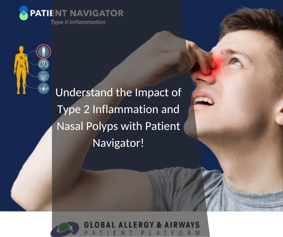 Do you know that having #NasalPolyps might seriously impact the quality of life? Visit the Patient Navigator on Type 2 Inflammation to learn more. #T2IPN: ow.ly/r0WJ50MpKPW 

#NasalPolypsAwareness #T2IPN #PatientNavigator #Type2Inflammation