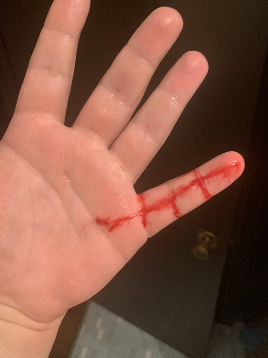 Dinnerfrieddin1's tweet photo. Fucking wanker of a #cat sliced me like a bitch https://t.co/GPPqPGUuym
