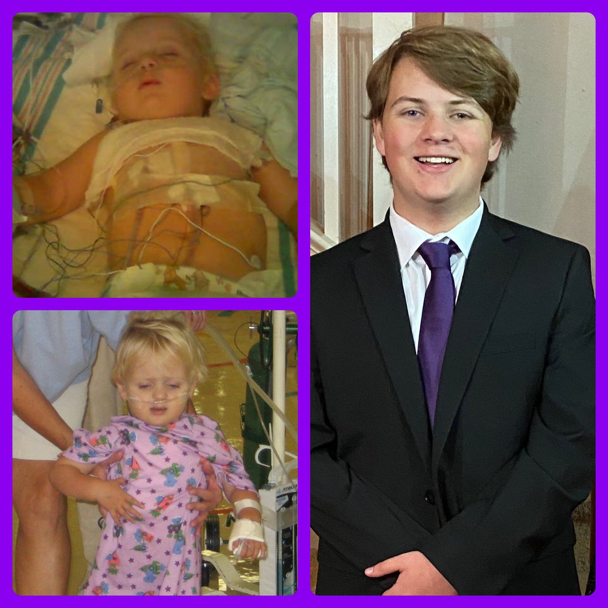 hansen1455's tweet photo. @edens_mama This is Logan. He was born with a heart condition called Double Outlet Right Ventricle with TGA, ASD &amp; VSD. He had 3 open heart surgeries before he turned 3. He will be 19 next month! He’s amazing (heart kiddos are something special)! Sending hugs to you mama! ❤️ https://t.co/Lu5lfX6dag