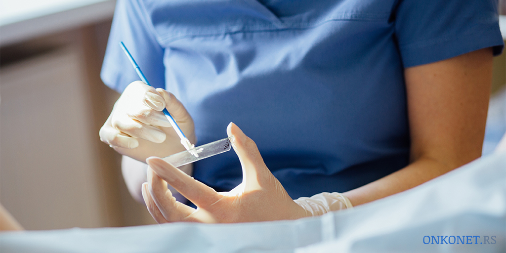 Onkonet_Srbija's tweet image. Kada da počnete sa skriningom?

Papa testove treba da počnete da radite sa 21 godinom, u dogovoru sa lekarom. Ako je vaš rezultat Papa testa normalan, vaš lekar će vam reći da možete da sačekate 1-3 godine do sledećeg Papa testa.

#papatest #preventiva