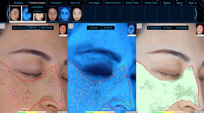 QuipDerma's tweet photo. The thing is to know the medical conditions that may be affecting the skin; the second step is to examine the skin history with the Skin Analyzer Equipment. This involves the products which have been used in the past, if they have had any adverse effects.

https://t.co/Tr7hGKb4Mr https://t.co/RpUm5lJcOC