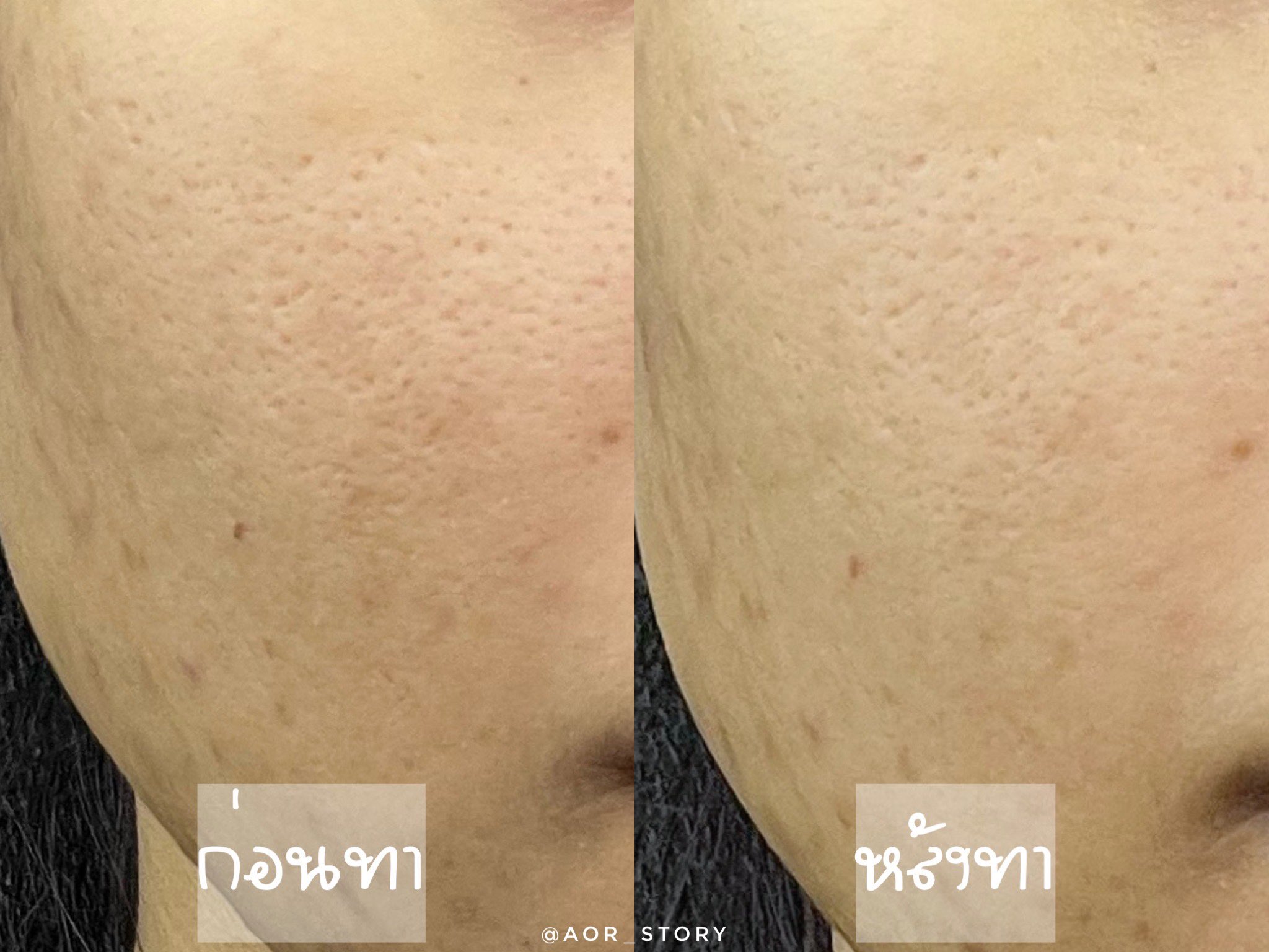 AOR STORY รีวิว (aor_story) / Twitter