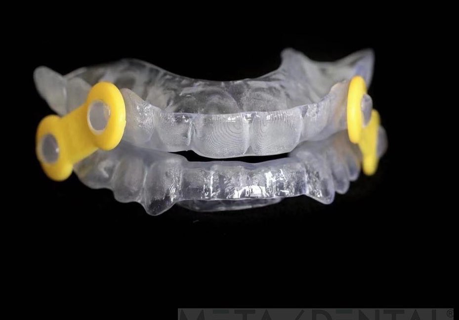 MetaDentalDE's tweet photo. #meta-dental Silensor https://t.co/6w68LALV7n