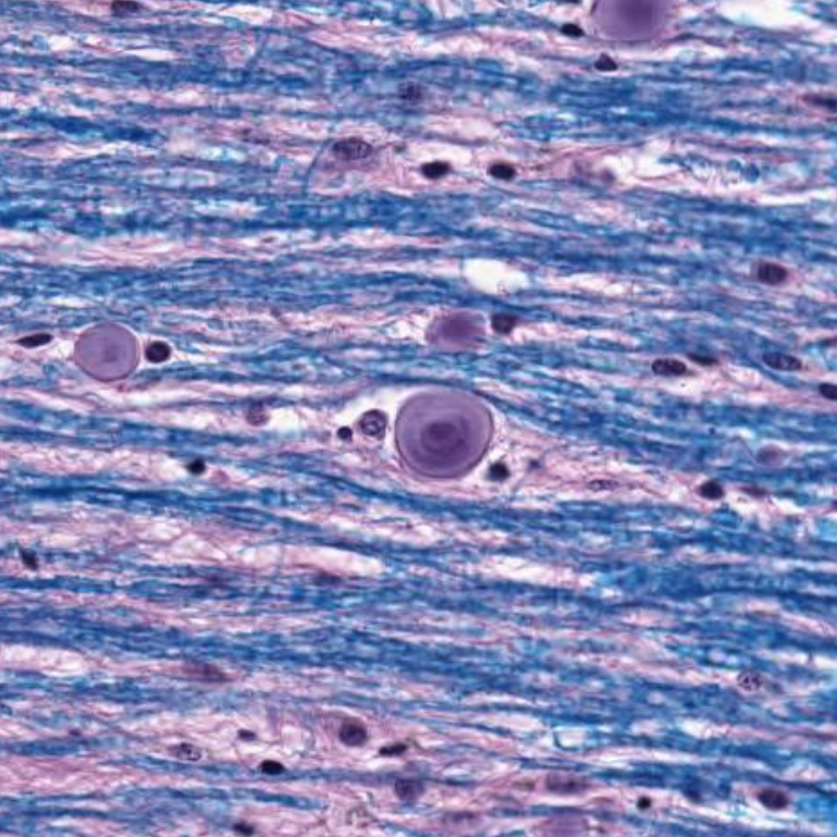 olkazuraw's tweet photo. Do you know the organ, 
structure, and stain? 

It sure makes a beautiful pattern! 

I found this one on @pathpresenter   

-----------------------------------  
#pathart 
#microscopicphotography 
#digitalpathology 
#computationalpathology 
#microphotography 
#neuropathology https://t.co/OKYR6wDrtg
