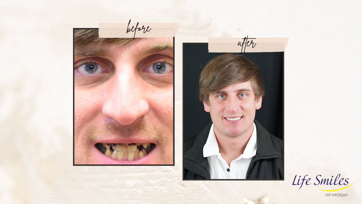henglimdds's tweet image. You deserve a smile you’re proud of.  We can help you change anything about your smile that you don’t like.  Let’s talk about how we can help boost your smile confidence.