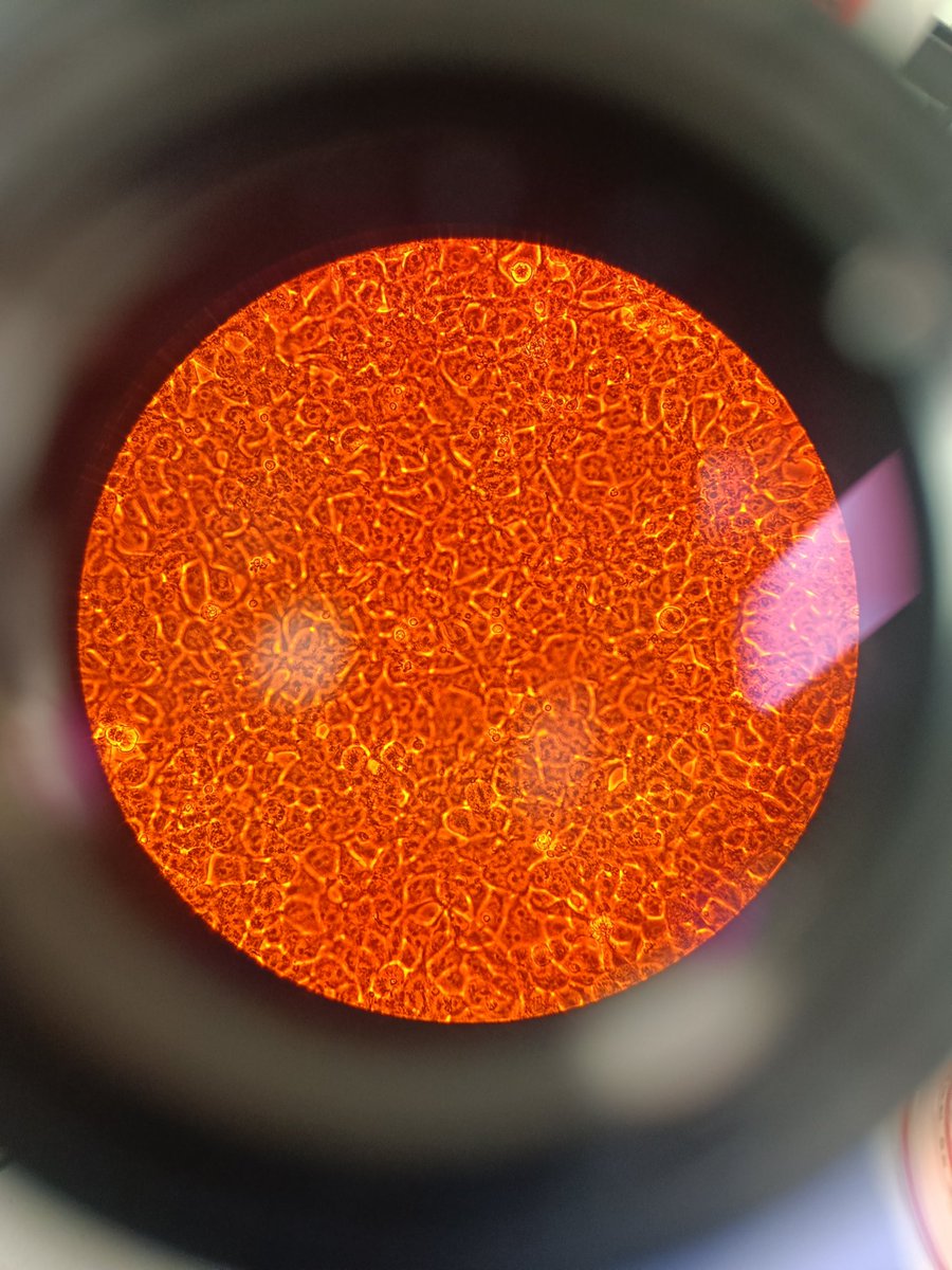 katatrepip's tweet photo. Our sun? No just extremely confluent human embryonic kidney cells who have no idea they're about to be infected with lentivirus. 
#HEK293T #GeneTherapy https://t.co/sH2yymW7Ai