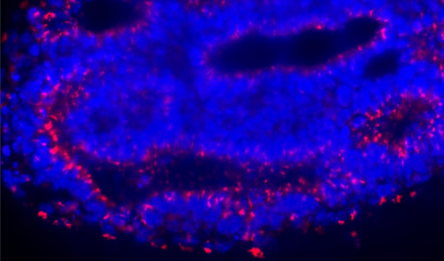 We are offering 4 year PhD position to study neural epithelial development and disease with organoids. The PhD will be carried <a href="/CABD_UPO_CSIC/">Centro Andaluz de Biología del Desarrollo</a> co-supervised by @Marconlab and <a href="/CarlosSantosOc/">Carlos Santos Ocaña</a> in  Seville, ☀️ Spain. Deadline 20/01/23. Apply at: tinyurl.com/yfe2szwc. Please RT