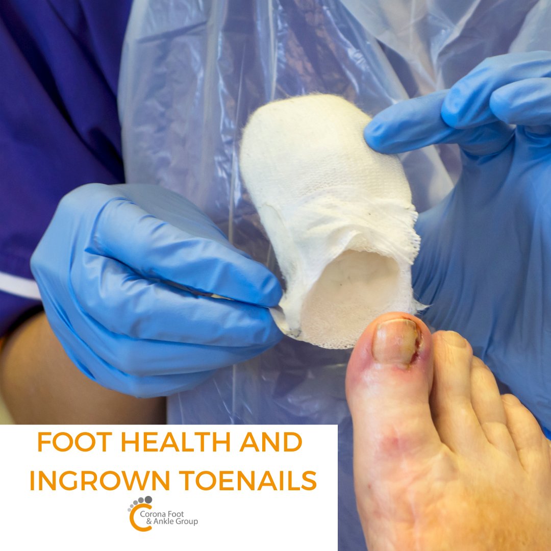 coronapodiatry's tweet photo. When you have an #ingrowntoenail, the pain is terrible. 

The initial symptom may be mild pain while wearing tight shoes or when applying pressure, but eventually, this can lead to swelling and redness. 

Schedule a consultation today. 

https://t.co/pRc1TObLTt https://t.co/q6ncAjU8yw