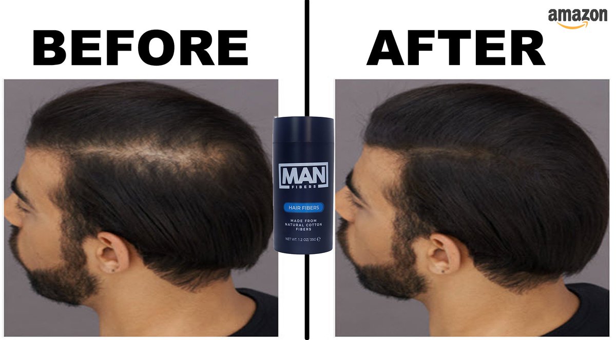 Hair loss doesn't have to mean the end of your stylish looks. Manfibers can help you achieve the full, thick hair you desire. 
-
-
-
-
-
-
-
-
-#hairlosssolution #manfibers #Toppik #Caboki #Nanogen #Hairlab #Kerafiber #DermMatch #Mrjamiestevens #Thickfiber