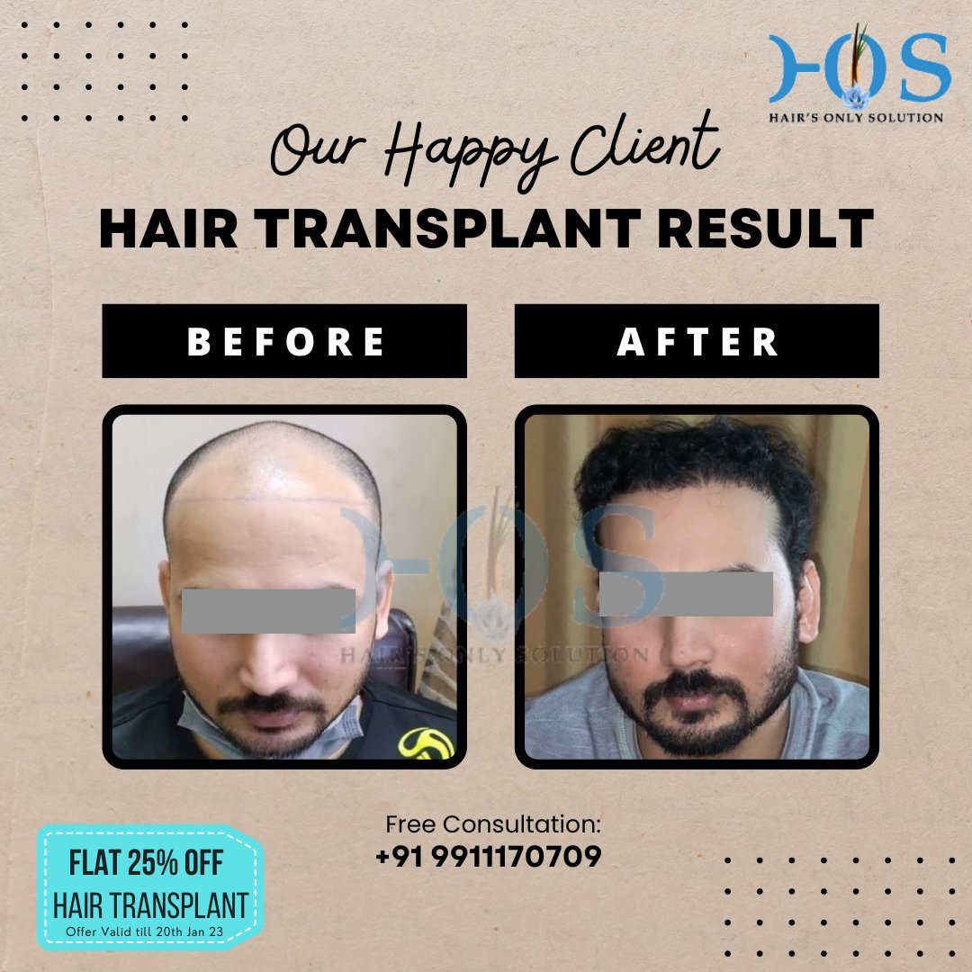 HOS Hair Clinic (@hoshairclinic) / Twitter HOS Hair Clinic (@hoshairclinic) / Twitter