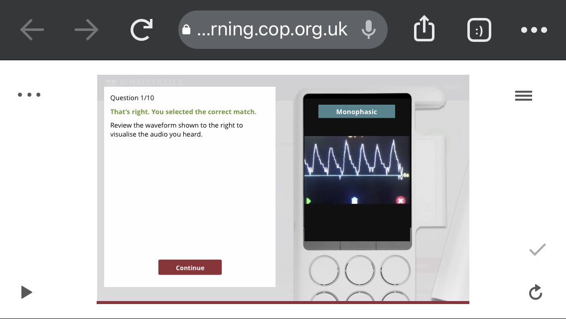 Martinfox2000's tweet photo. Whether it’s monophasic or irregular, it’s important to detect &amp; report. @RoyColPod members can access this great CPD for free 👍.. listen, look, learn and take the Doppler interpretation test. Go on.. Have a go. 2 ✅ for me so far.. 😅 Best on a PC / laptop 🦵🫀 ⚡️ https://t.co/RRCZuYh7Ok