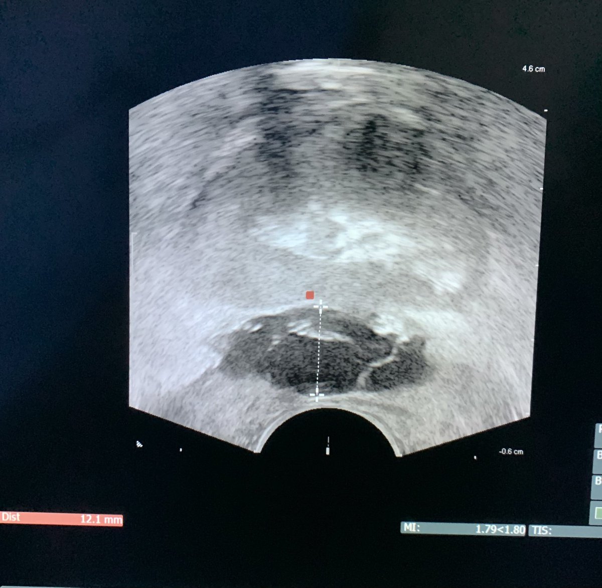 Dr. Ivan Azael Martinez tweet media