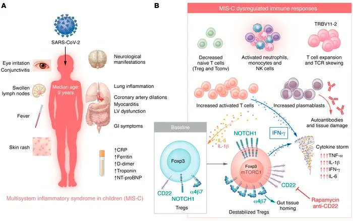 jclinicalinvest's tweet photo. Notch1 signaling impairs regulatory T cells during multisystem inflammatory syndrome in children: https://t.co/yVEO03ASCG 
@magalinoval &amp; @ArditiMd @CedarsSinai highlight the NOTCH1/CD22 pathway during MIS-C &amp; suggest relevancy in other hyperinflammatory syndromes; #Commentary https://t.co/k8SrP1KJ2N