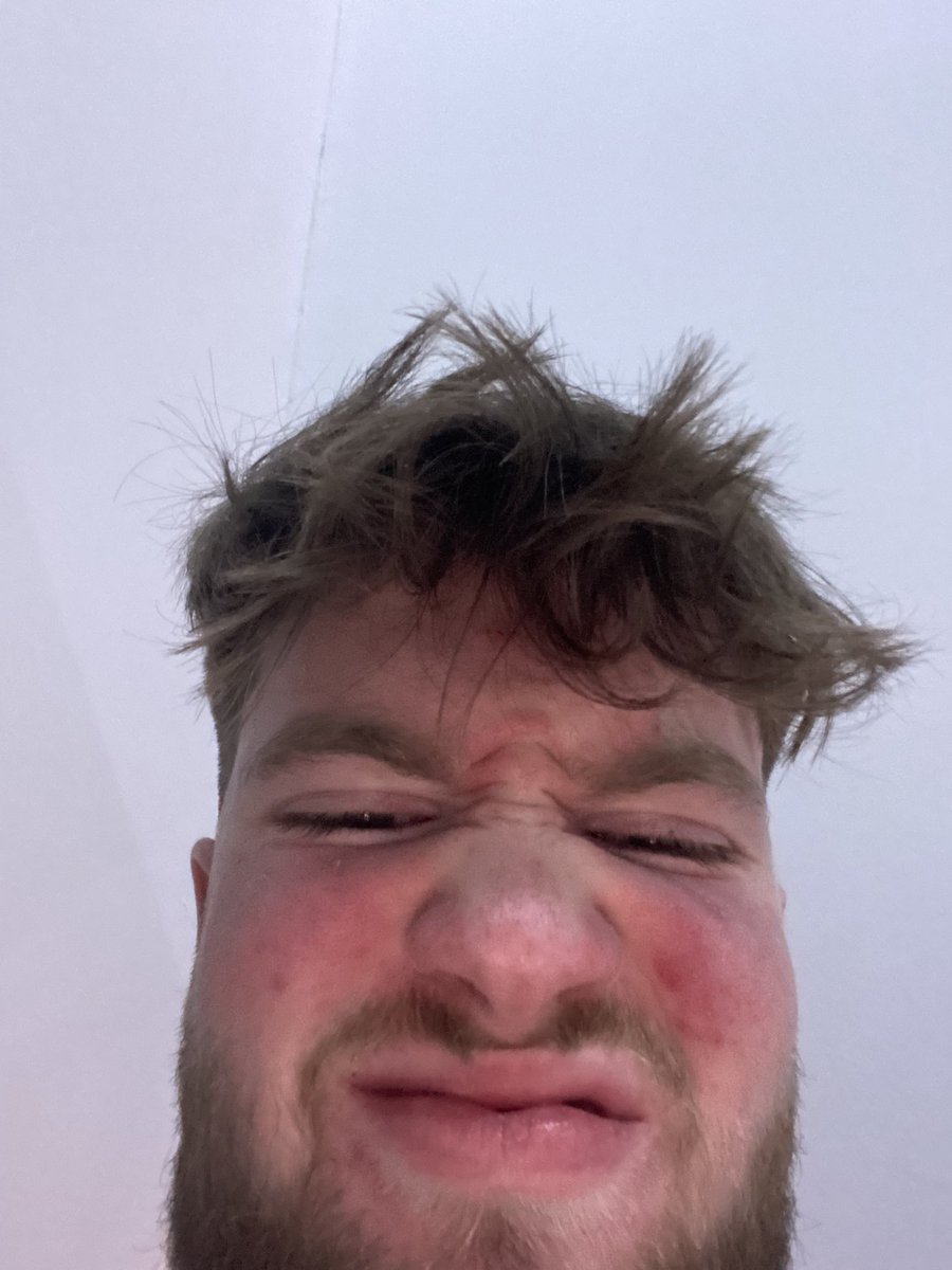 WAVE Chanti on Twitter "WARUM SAH ICH IM SOMMER SO COOL AUS UND JETZT SEHE ICH AUS WIE EINE LEICHE"