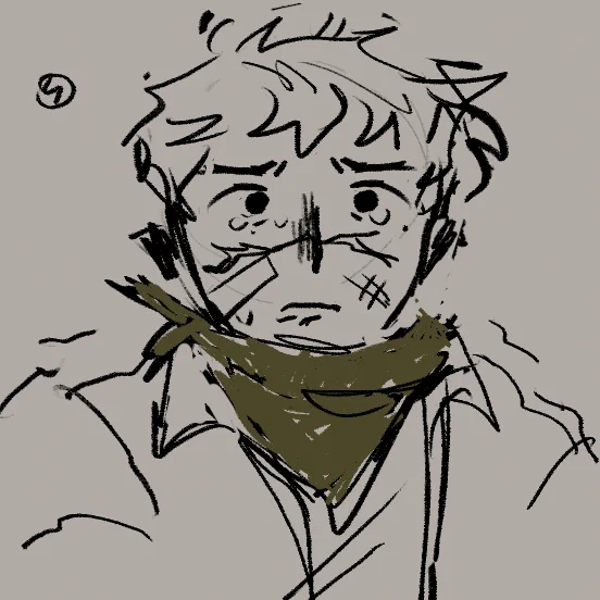 tcd is actually attached to my brain surgically (1/2) 