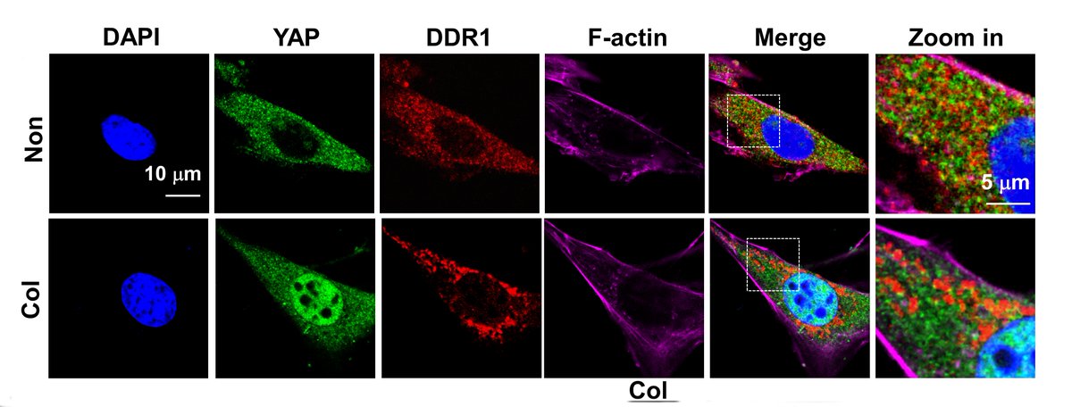 CircRes's tweet photo. Liu & colleagues demonstrate in #VSMCs, activation of #DDR1 promotes #YAP activation through inhibiting the Hippo pathway kinase #LATS1. Learn how targeting DDR1-LATS1 LLPS can be used as an anti-arterial stiffening strategy at https://t.co/oRoKlHFNdj
@PKU1898 https://t.co/dr6evwNUsu