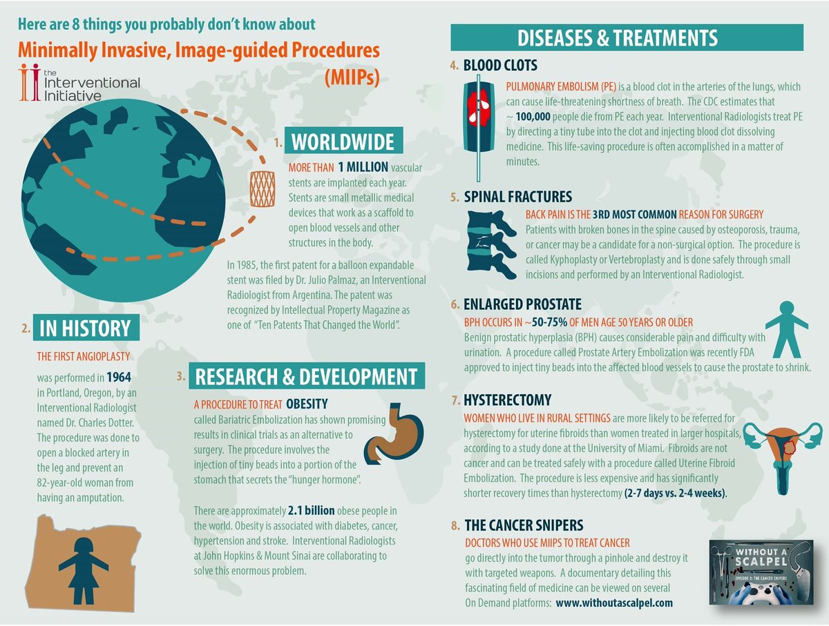 Interventional2's tweet image. Minimally Invasive, Image-guided Procedures (#MIIPs) are an alternative way for patients to receive treatment. #WAS2023 #WithoutAScalpelDay