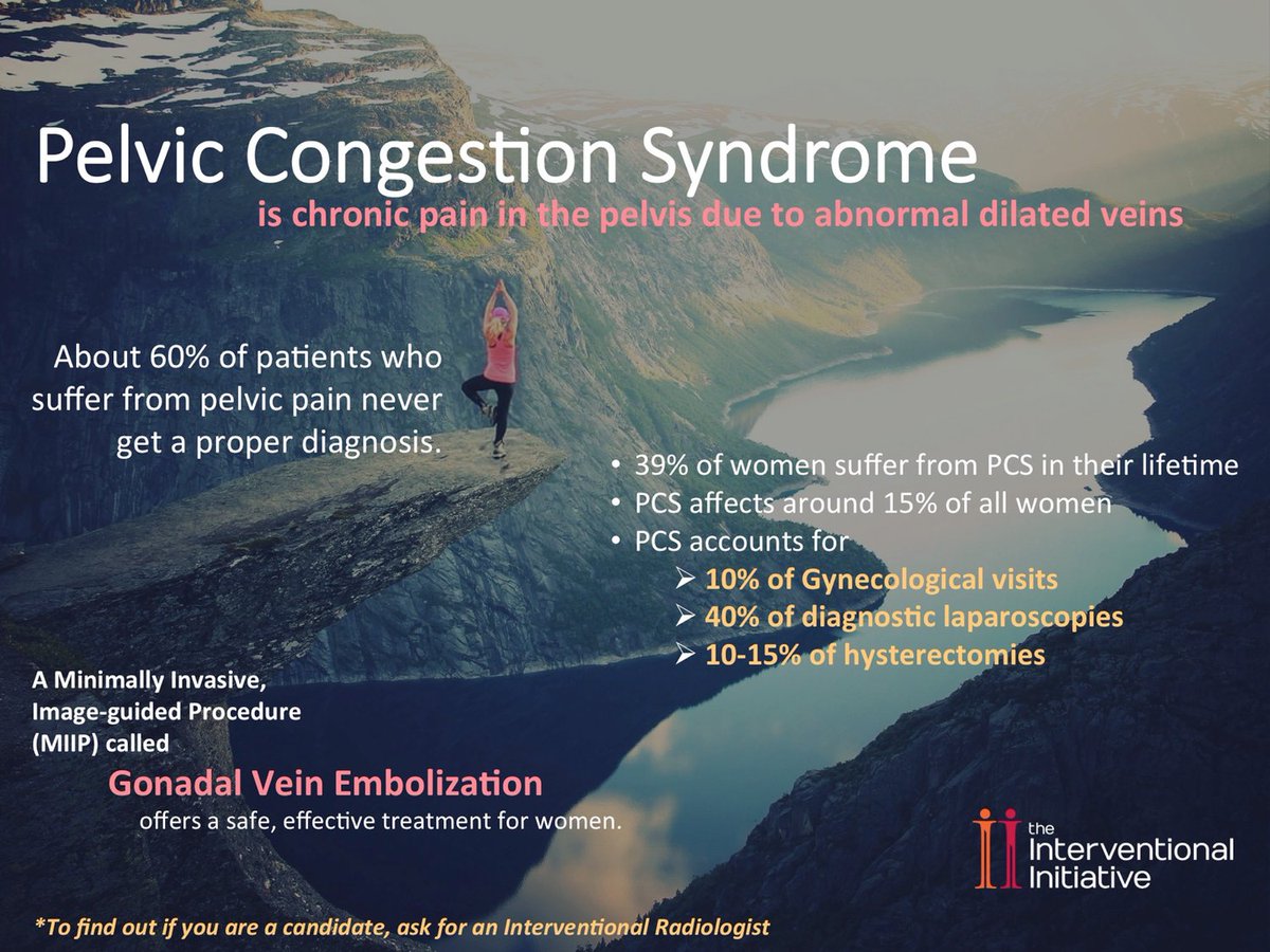 Interventional2's tweet image. 39% of Women suffer from Pelvic Congestion Syndrome (PCS) in their lifetime. Gonadal Vein Embolization is a safe, effective treatment. #WithoutAScalpelDay #WAS2023